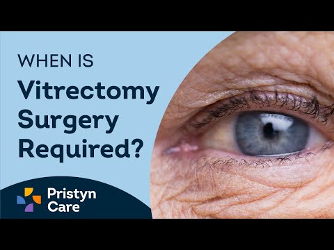 What is Vitrectomy Surgery? | Pristyn Care