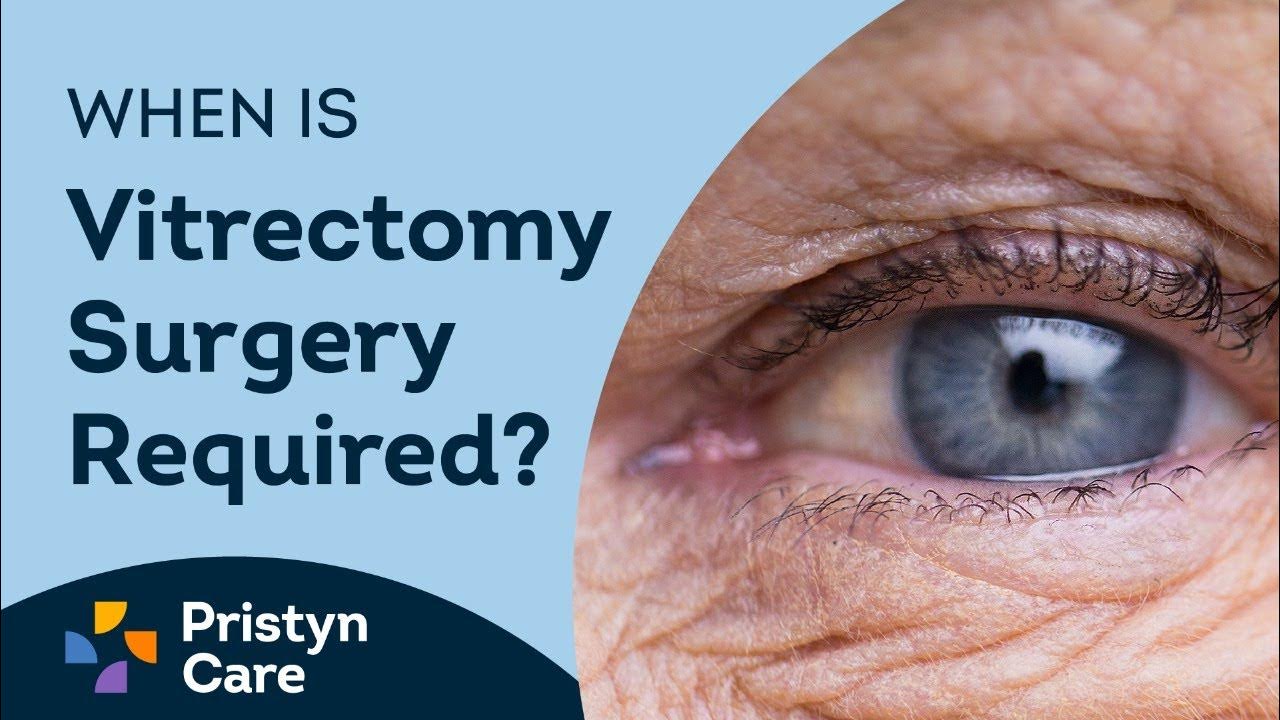 what-is-vitrectomy-surgery-why-is-vitrectomy-surgery-required-youtube