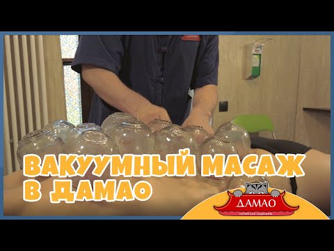 ДАМАО - Центры китайской медицины - Вакуумный массаж