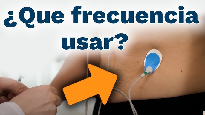 Electroterapia en fisioterapia: ¿Qué es y cómo funciona