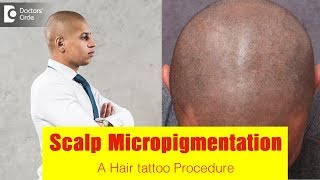 Hair tattoo / Scalp Micro Pigmentation(SMP)| Will it damage hair follicles? - Dr. Rajdeep Mysore