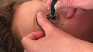 Example #3 hard lens insertion and removal in older child