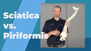 True Sciatica VS Piriformis Syndrome