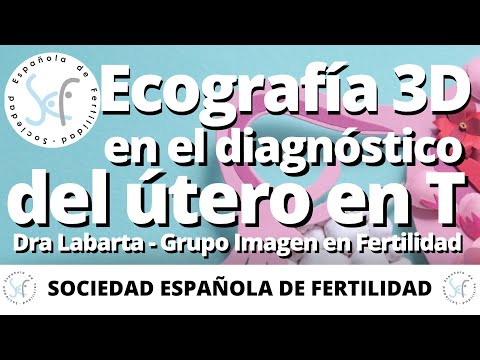 Vídeo: En La Imagen, La Ecografía Muestra La 