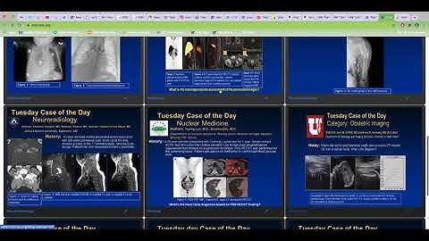 Virtual RSNA 2020: How to view lectures, educational exhibits and cases of the day