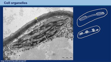 Identifying structures in electron micrographs