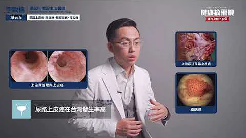 【李致樵醫師】無痛血尿勿輕忽！中年男罹患尿路上皮癌｜健康醫療網 - 天天要聞