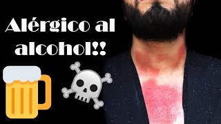 De después alcohol piel beber dolorosa al tacto