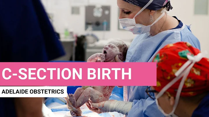 C-sections: Giving birth by cesarean section - DayDayNews