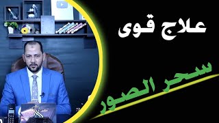 علاج قوى سحر الصور الاسود