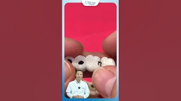 Cầu Răng Sứ 4 Răng | Bác Sĩ Yên