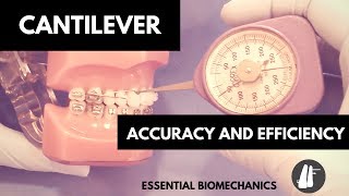 Cantilever | Essential Biomechanics
