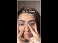 How to reduce #Hereditary #darkcircles with #Faceyoga at home!