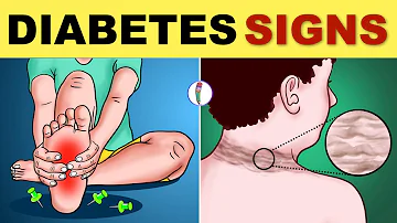 Wat zijn de eerste tekenen van diabetes?