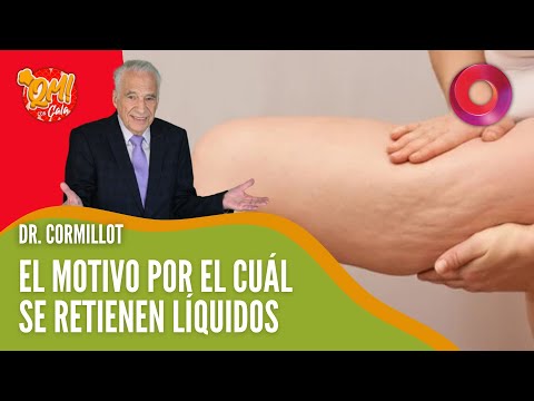 Dr. Alberto Cormillot: La retención de líquidos