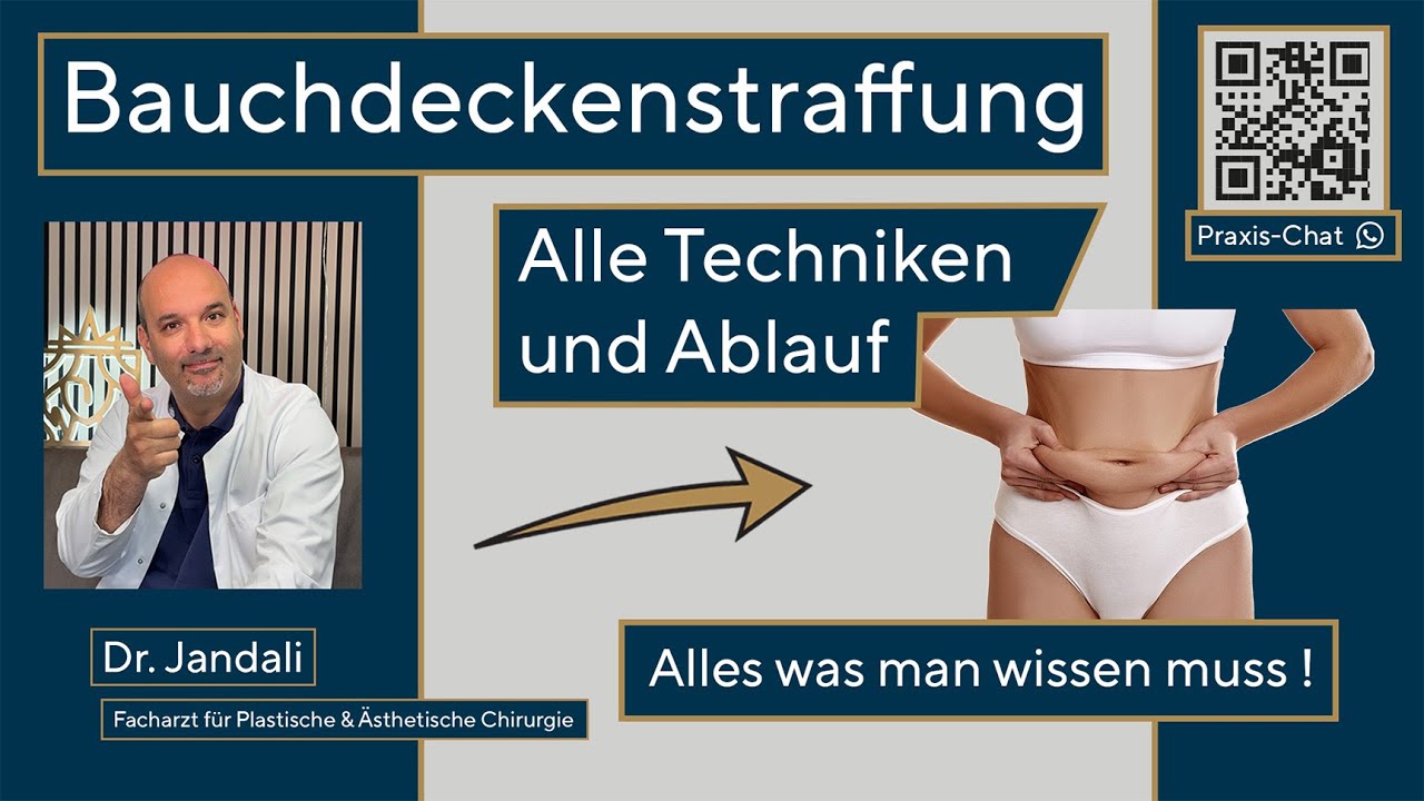 Bauchdeckenstraffung erklärt: Methoden, Risiken, Bodylift & Mini-Abdominoplastik 🧑‍⚕️ | Infos zur OP