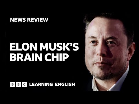 Elon Musk's Brain Chip: Bbc News Review