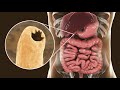 Phylum Nematoda Part 2: The Parasitic Nematodes