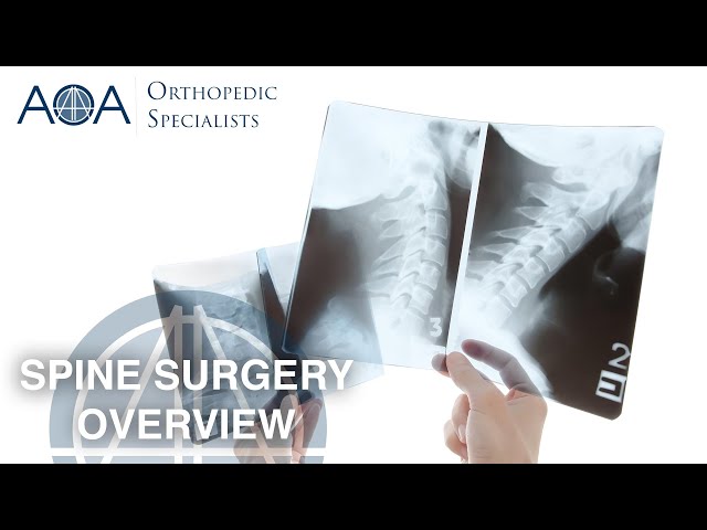 AOA Orthopedic Specialists - BOSHA - Spine Surgery Overview