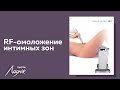 RF-омоложение интимных зон на аппарате Exilis Ultra 360 в Бьюти Лаунж