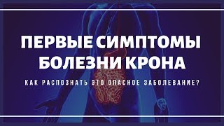 Первые симптомы болезни Крона