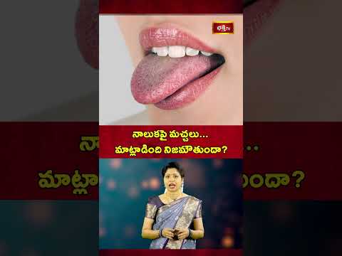 నాలుకపై మచ్చలు మాట్లాడింది నిజమౌతుందా | Black Spots on Tongue #MythsVsFacts