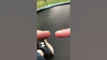 Thumbnail of ⚡️ Static Electricity ⚡️ Caught in Slow-Mo