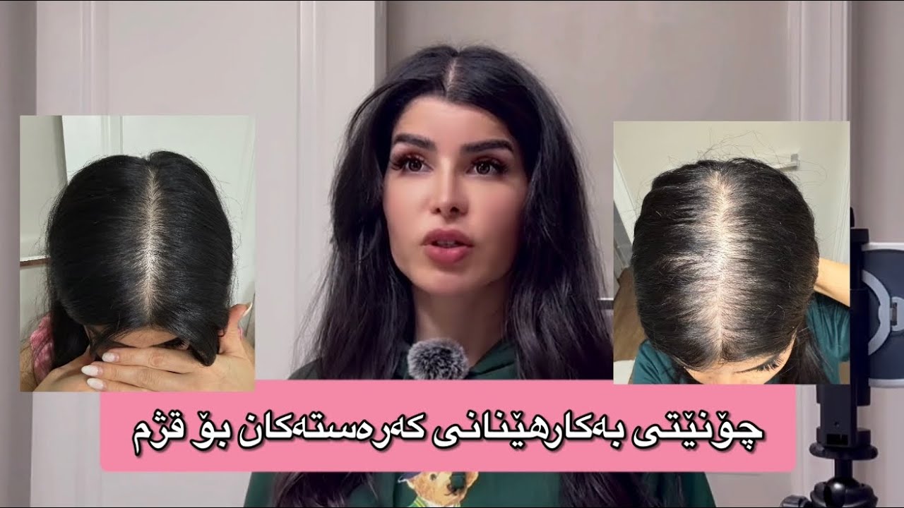 چۆنێتی بەکارهێنانی - Minoxidil 5% و Dermaroller وە سرکەی سێوو خوێی دەریایی و زەیتە سروشتیەکان بۆ قژم