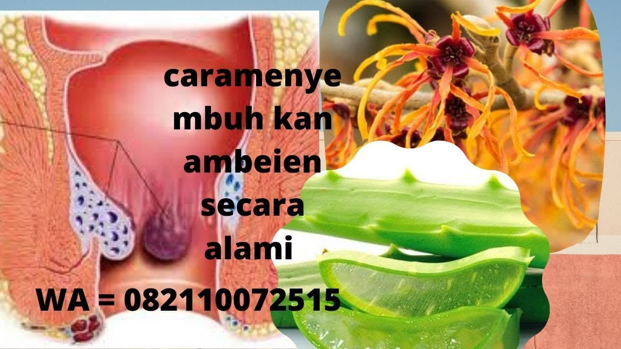 cara menyembuhkan ambeien secara alami