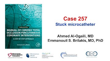 Case 257: Manual of CTO PCI - Stuck microcatheter