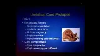 Obstetric emergencies