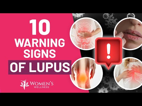 10 Vital Warning Signs Of Lupus