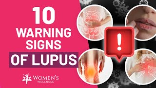 10 Vital Warning Signs of Lupus