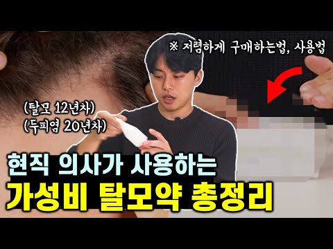   탈모 12년차 의사가 추천하는 탈모약 총정리 탈모 지루성두피염