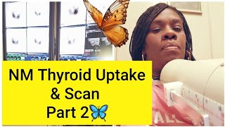 NM Thyroid Uptake & Scan |Hyperthyroidism |Part 2 🦋