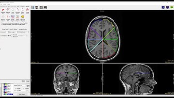 Analyze 15.0 - Segment: Divide Regions into Radial Sections
