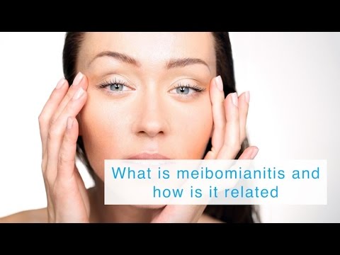 What is meibomianitis and how is it treated?