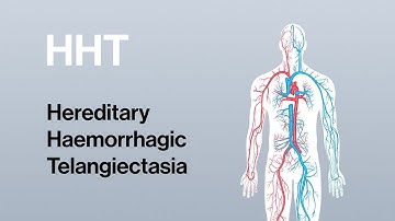 Understanding HHT – Motion Graphics Preview