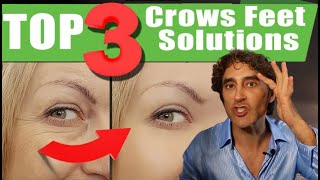 TOP 3 WAYS to TREAT CROWS FEET