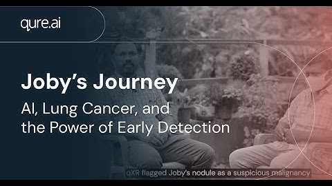 Saving Lives with AI: Joby’s Story of Early Lung Cancer Detection