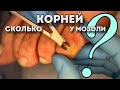 Почему образовывается мозоль на мизинце