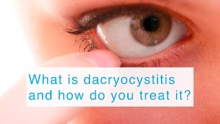 What is dacryocystitis and how do you treat it?