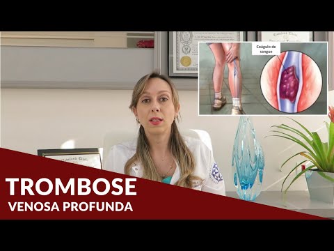 Trombose Venosa Profunda - Dra. Nayara Cioffi Batagini