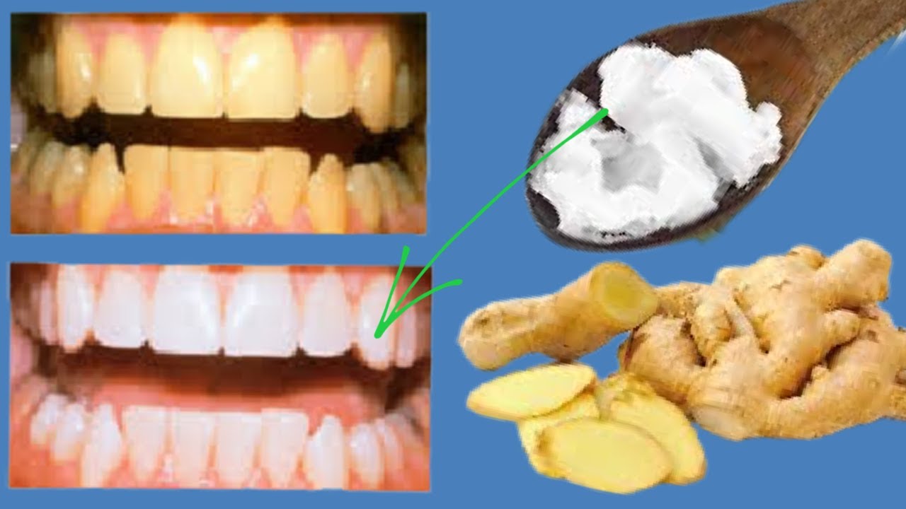 JUST 3 MINUTES TO WHITEN YELLOW, BROWN TEETH, GET A WHITER SMILE FAST ...