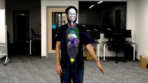 Augmented Reality Anatomy Visualization for Surgery Assistance with HoloLens