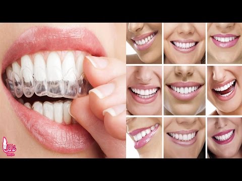 What وصفة لتبيض الاسنان عن تجربة