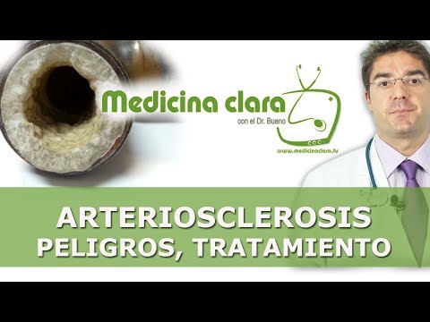 Vídeo: ¿Es Posible Revertir La Aterosclerosis?