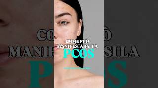 PCOS e ACNE