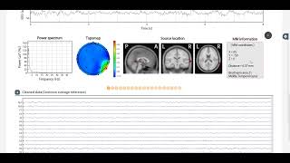 Manual Denoising with iSyncBrain Tutorial