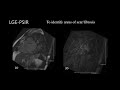 TMT: Cardiac MRI Pulse sequences by Dr Avanti Gulhane